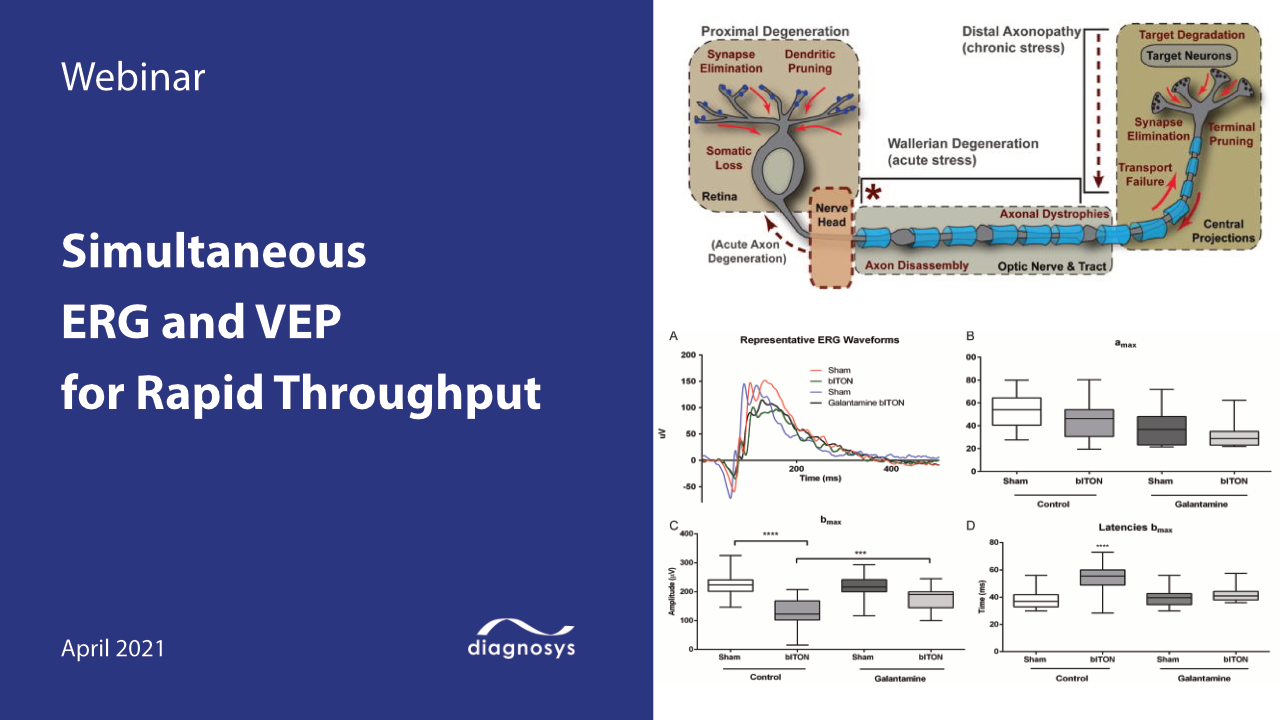 P505 - Párkinson a través del diagnósito Visual